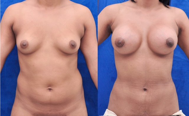 Franklin Peña - Santo Domingo - Franklin Peña - Santo Domingo