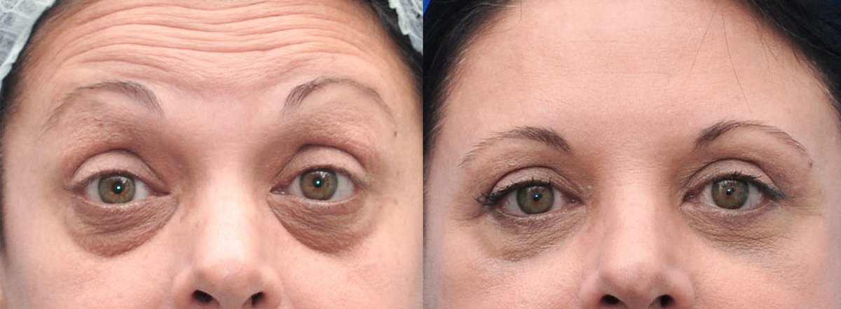 Franklin Peña - Santo Domingo - Franklin Peña - Santo Domingo