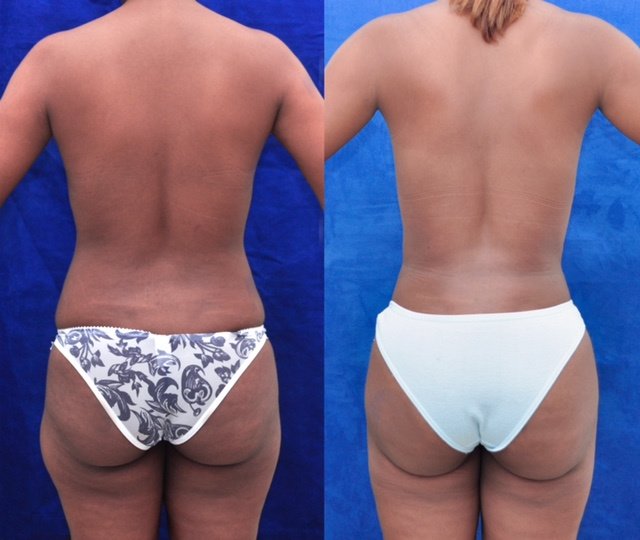 Franklin Peña - Santo Domingo - Franklin Peña - Santo Domingo