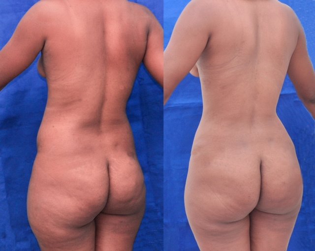 Franklin Peña - Santo Domingo - Franklin Peña - Santo Domingo