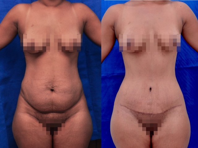 Franklin Peña - Santo Domingo - Franklin Peña - Santo Domingo