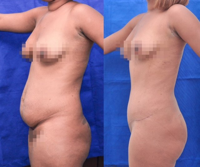 Franklin Peña - Santo Domingo - Franklin Peña - Santo Domingo