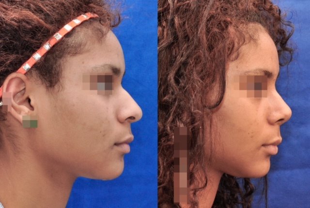 Franklin Peña - Santo Domingo - Franklin Peña - Santo Domingo