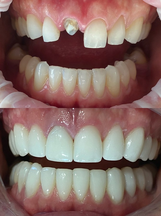 Fross Clinic - Fross Clinic