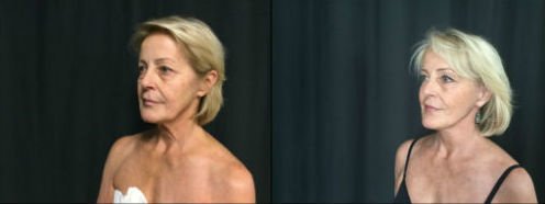 Galardi-Rosenblum Plastic Surgery - Galardi-Rosenblum Plastic Surgery