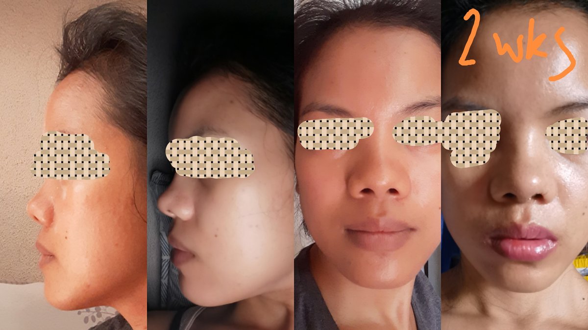 Gannaban & Hernandez, Plastic Surgeons - Gannaban & Hernandez, Plastic Surgeons