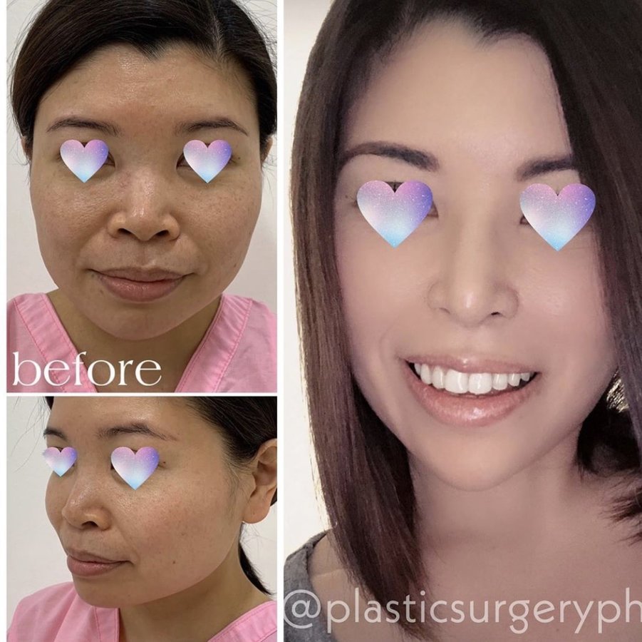 Gannaban & Hernandez, Plastic Surgeons - Gannaban & Hernandez, Plastic Surgeons