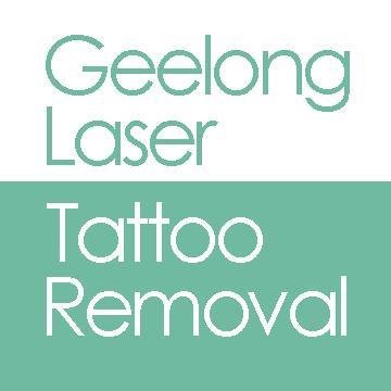 Geelong Laser Tattoo Removal - Geelong Laser Tattoo Removal