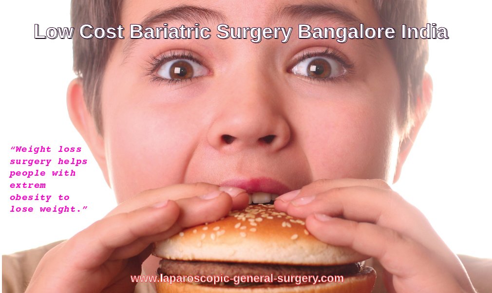 General and Laparoscopic Surgery India - General and Laparoscopic Surgery India