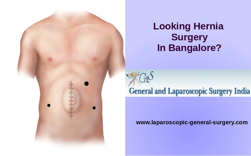 General and Laparoscopic Surgery India - General and Laparoscopic Surgery India