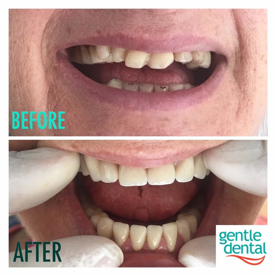 Gentle Dental Clinic - Crete - Gentle Dental Clinic - Crete