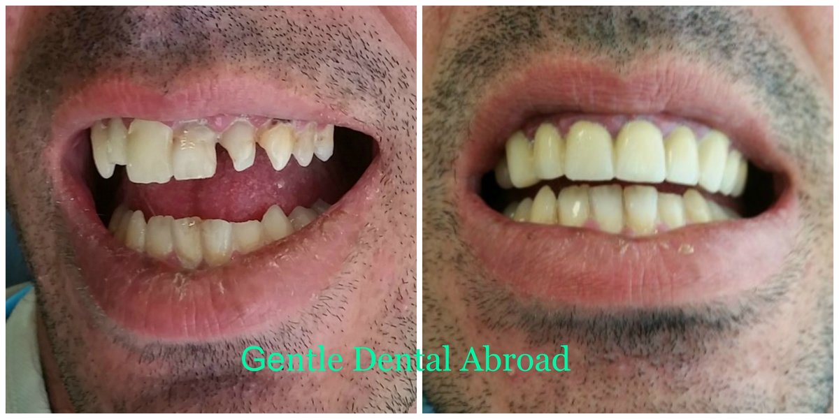 Gentle Dental Clinic - Crete - Gentle Dental Clinic - Crete