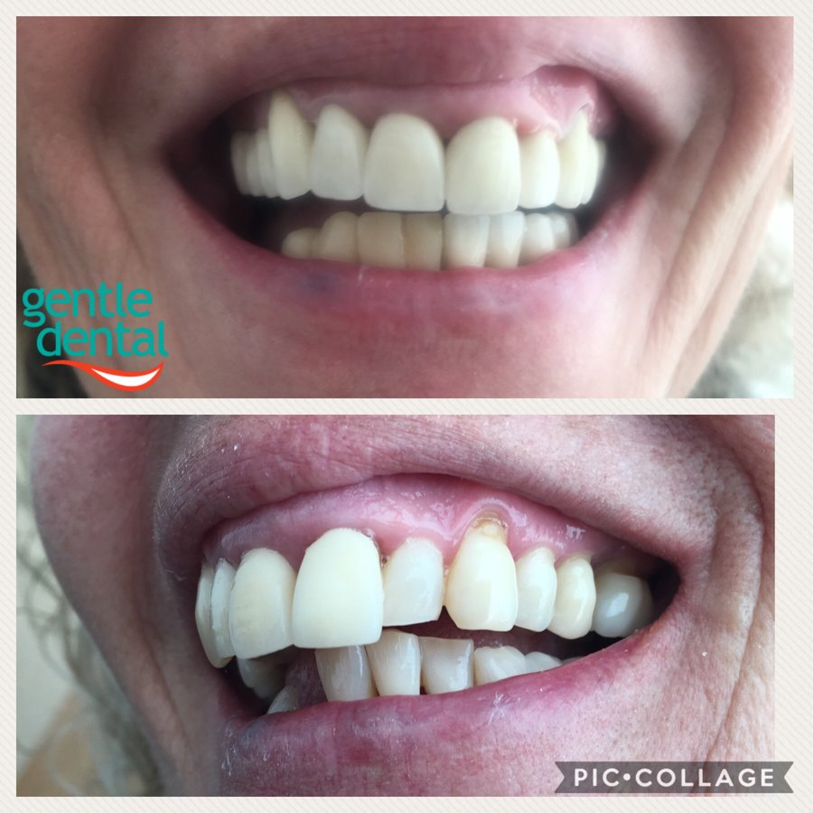Gentle Dental Clinic - Crete - Gentle Dental Clinic - Crete