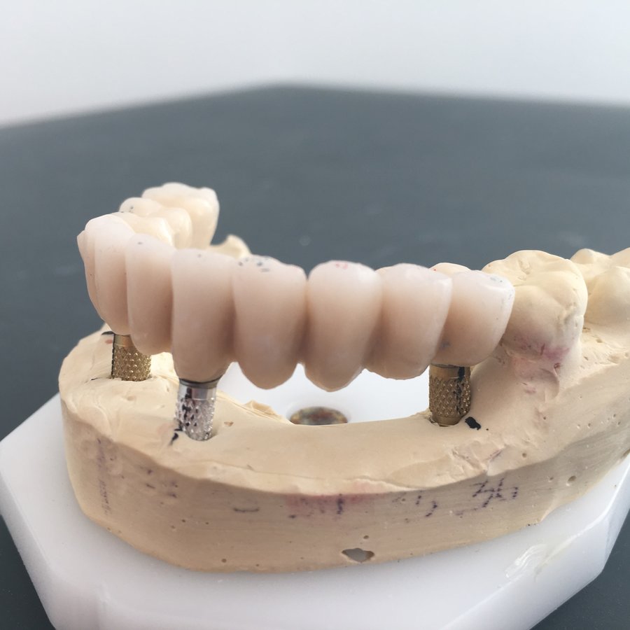Gentle Dental Clinic - Crete - Gentle Dental Clinic - Crete