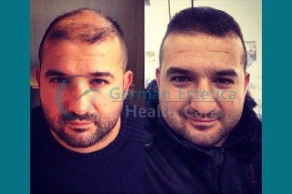 German Estetica - German Estetica