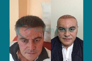 German Estetica - German Estetica