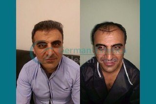 German Estetica - German Estetica