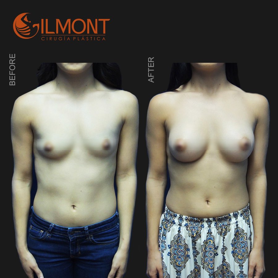 Gilmont Plastic Surgery - Gilmont Plastic Surgery