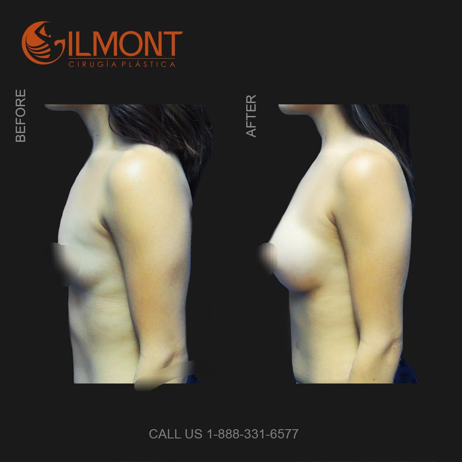Gilmont Plastic Surgery - Gilmont Plastic Surgery