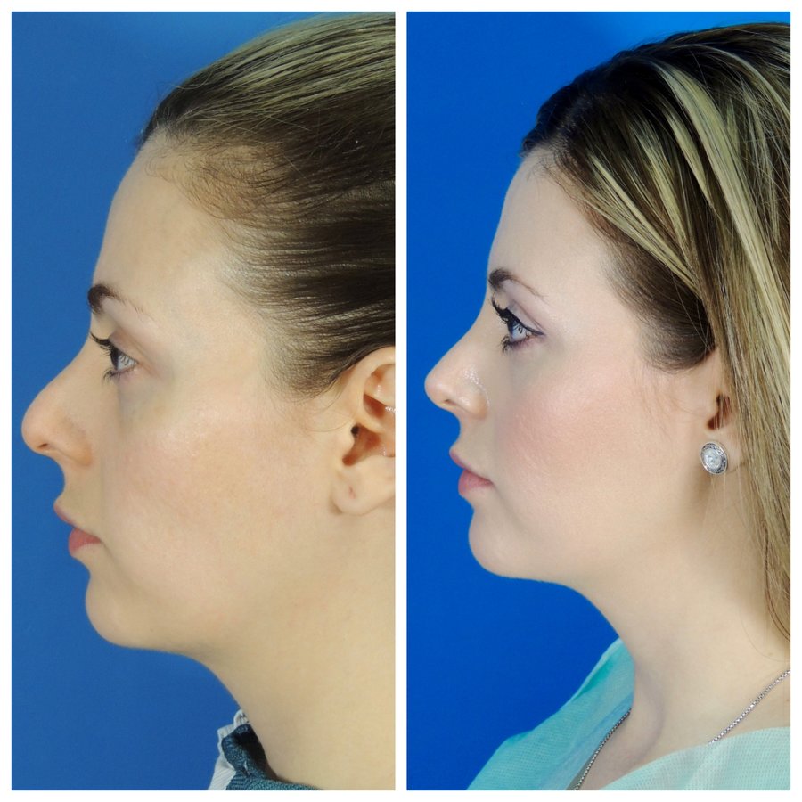 Gilmont Plastic Surgery - Gilmont Plastic Surgery