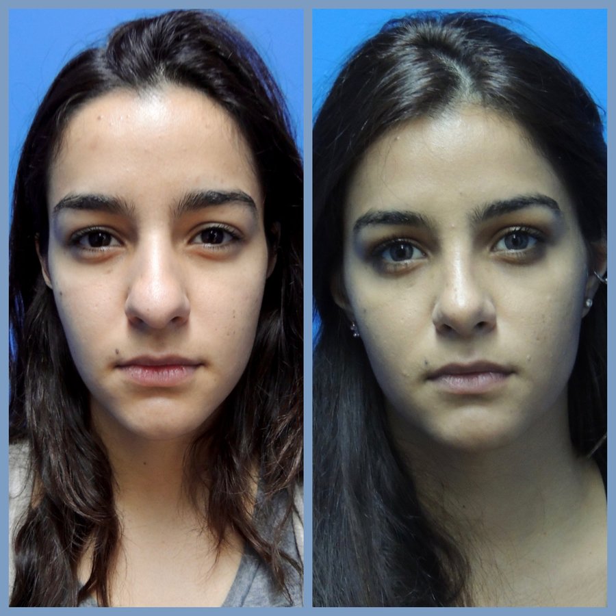 Gilmont Plastic Surgery - Gilmont Plastic Surgery