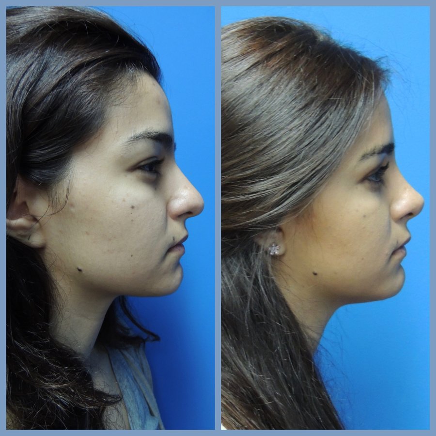 Gilmont Plastic Surgery - Gilmont Plastic Surgery