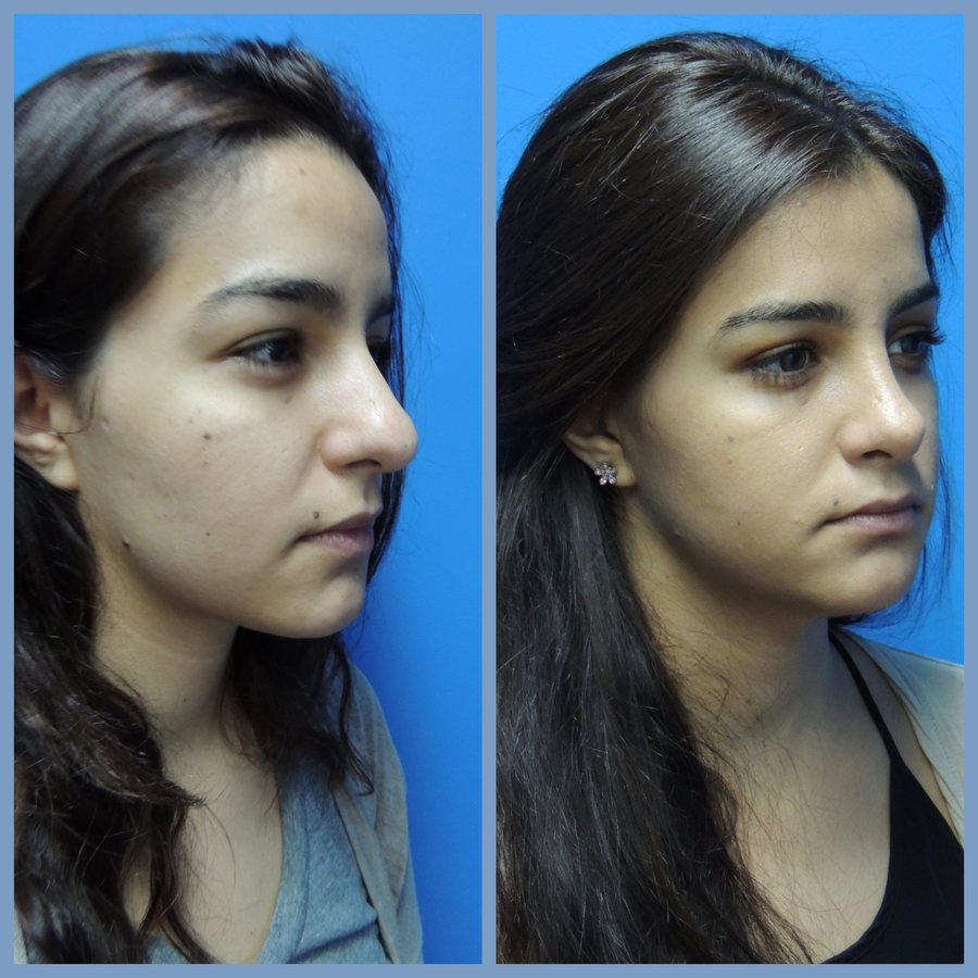 Gilmont Plastic Surgery - Gilmont Plastic Surgery