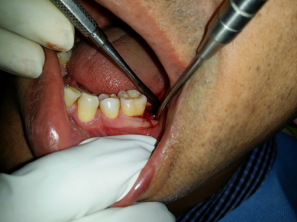 Girdhar Dental Clinic - Girdhar Dental Clinic