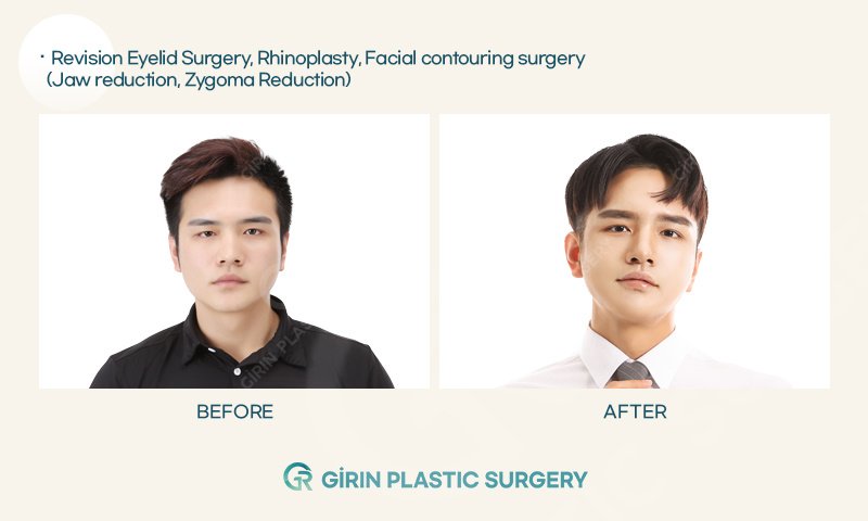 Girin Plastic Surgery - Girin Plastic Surgery
