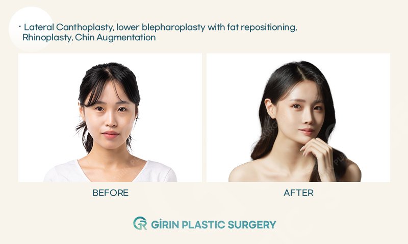 Girin Plastic Surgery - Girin Plastic Surgery