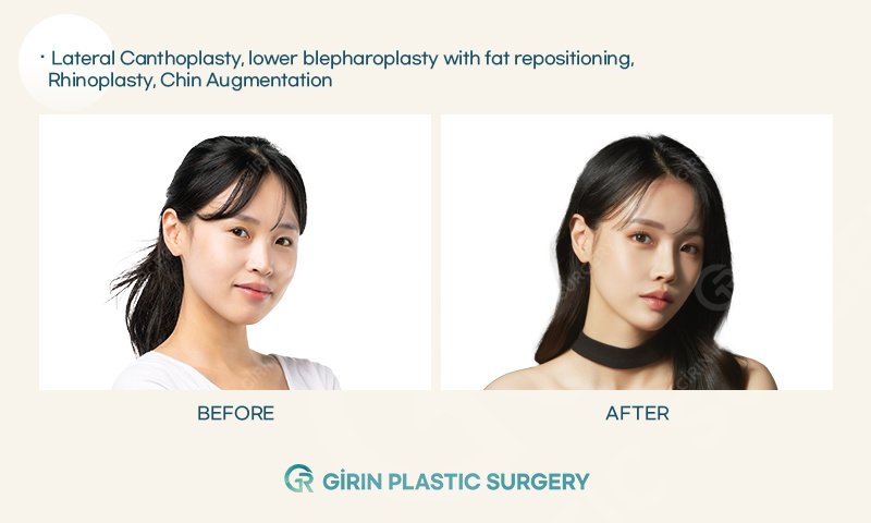 Girin Plastic Surgery - Girin Plastic Surgery