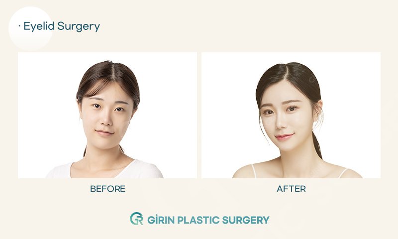 Girin Plastic Surgery - Girin Plastic Surgery