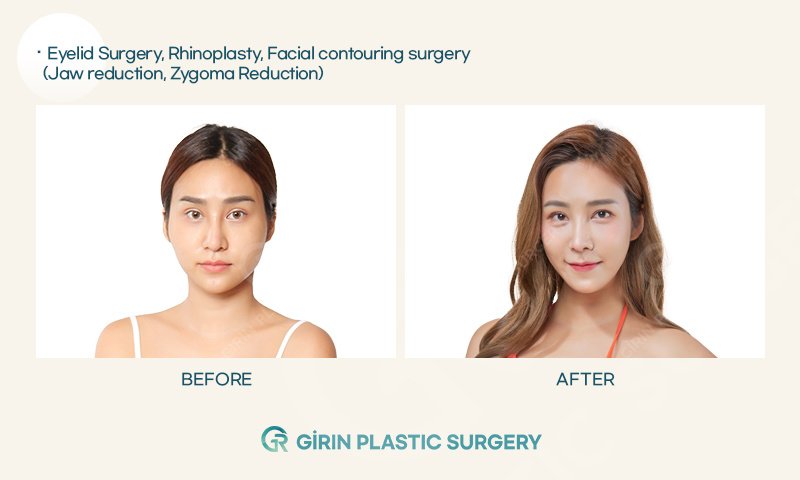 Girin Plastic Surgery - Girin Plastic Surgery