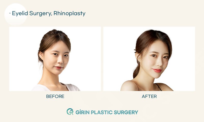 Girin Plastic Surgery - Girin Plastic Surgery