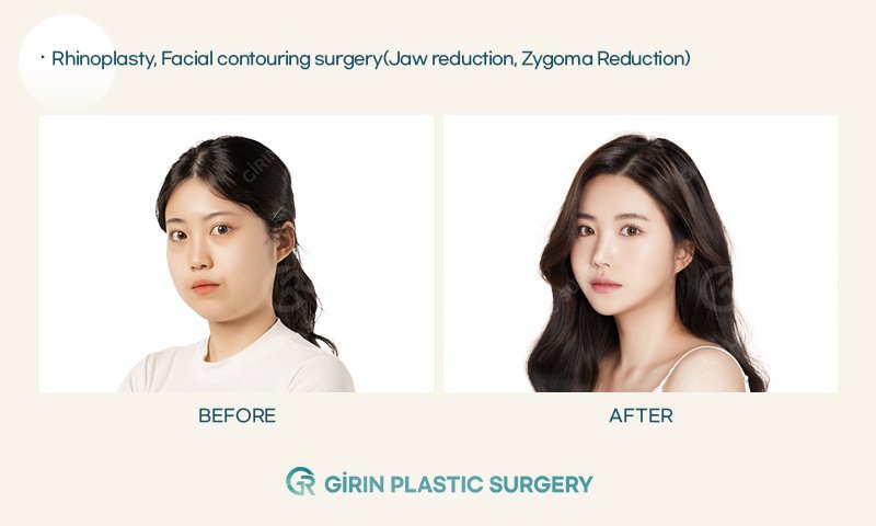 Girin Plastic Surgery - Girin Plastic Surgery