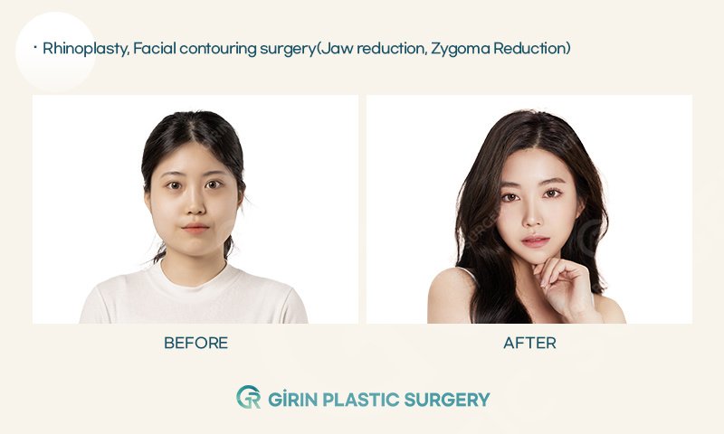 Girin Plastic Surgery - Girin Plastic Surgery