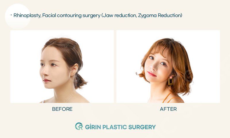 Girin Plastic Surgery - Girin Plastic Surgery