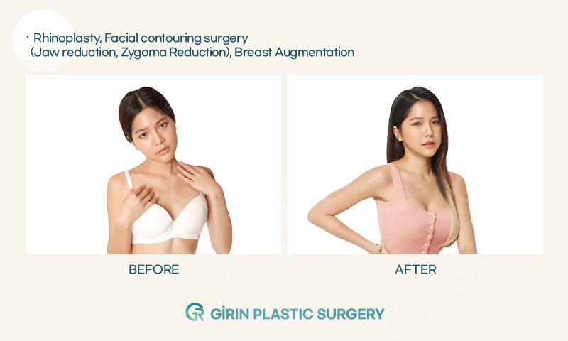 Girin Plastic Surgery - Girin Plastic Surgery