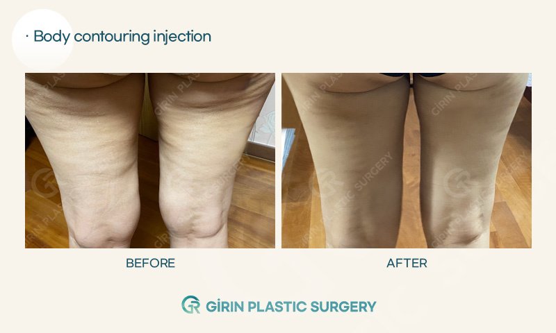 Girin Plastic Surgery - Girin Plastic Surgery