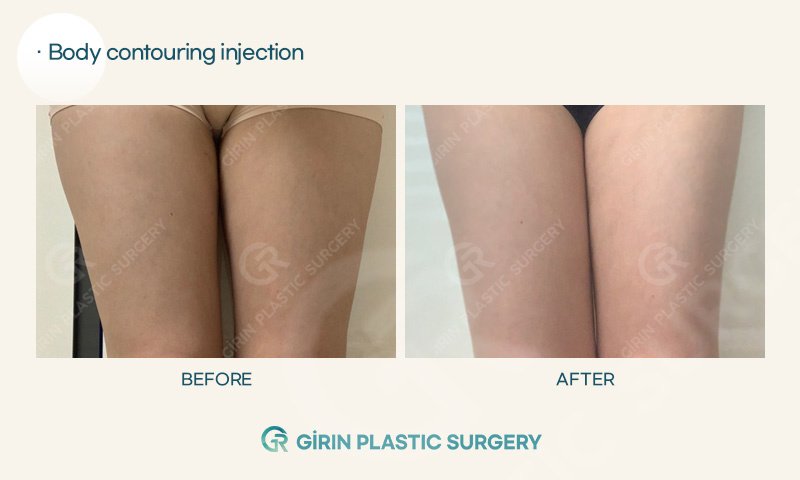 Girin Plastic Surgery - Girin Plastic Surgery