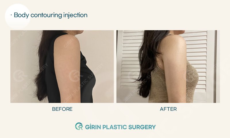 Girin Plastic Surgery - Girin Plastic Surgery