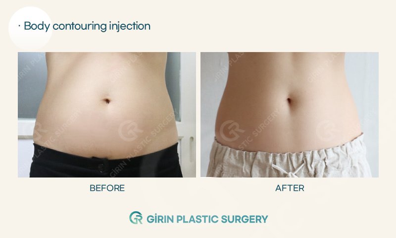 Girin Plastic Surgery - Girin Plastic Surgery