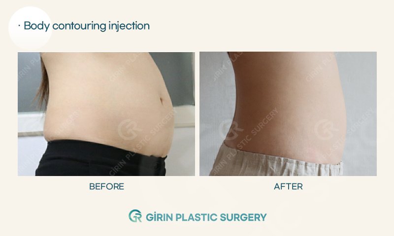 Girin Plastic Surgery - Girin Plastic Surgery