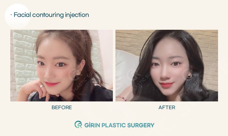 Girin Plastic Surgery - Girin Plastic Surgery