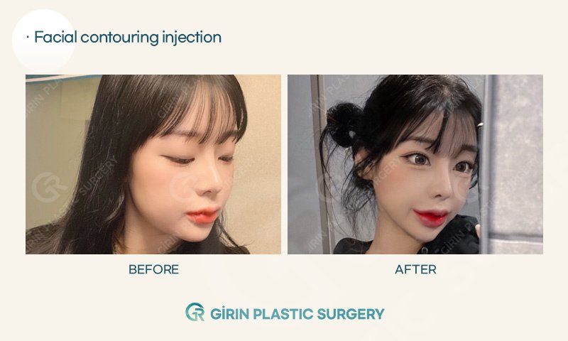 Girin Plastic Surgery - Girin Plastic Surgery
