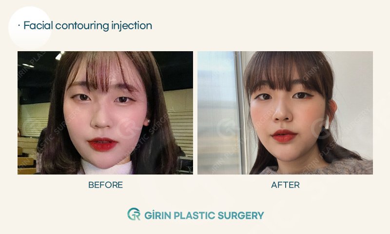 Girin Plastic Surgery - Girin Plastic Surgery
