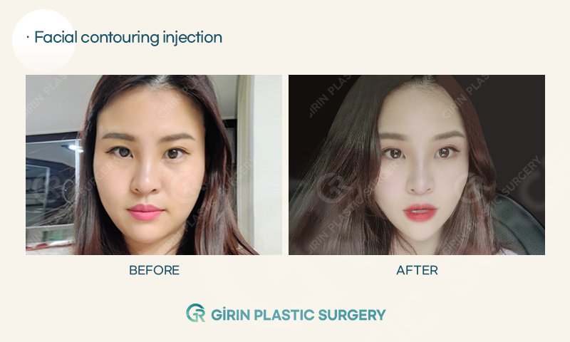 Girin Plastic Surgery - Girin Plastic Surgery
