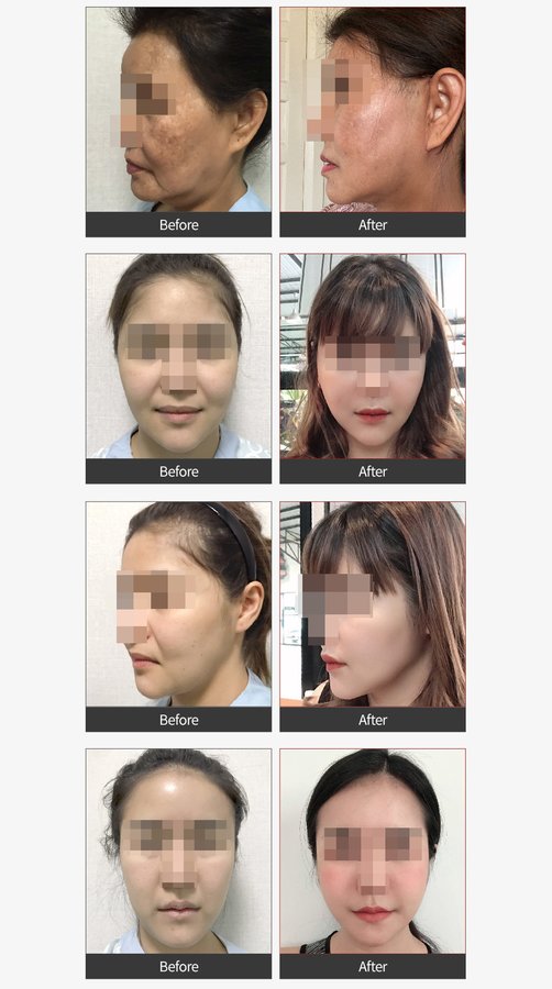 Girin Plastic Surgery - Girin Plastic Surgery