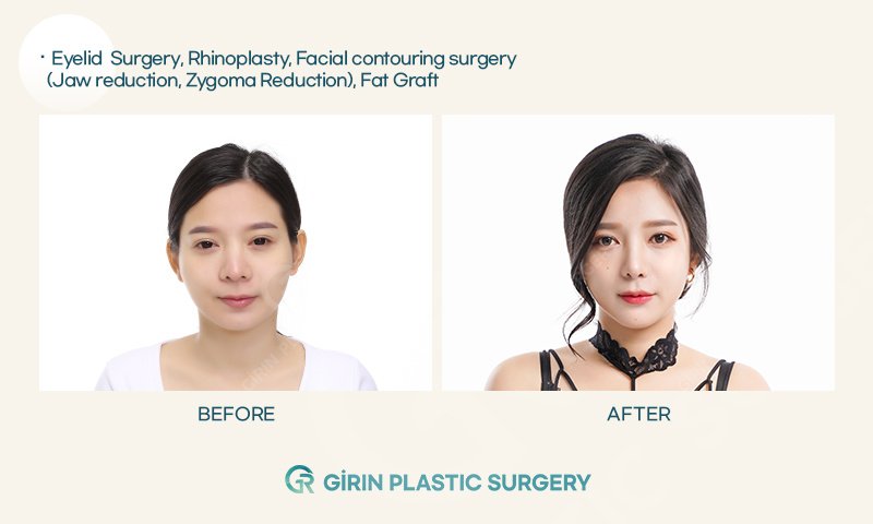 Girin Plastic Surgery - Girin Plastic Surgery