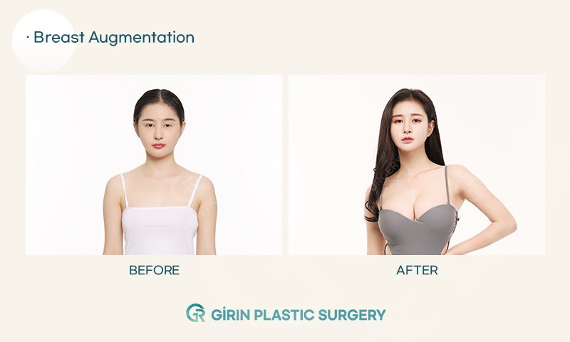 Girin Plastic Surgery - Girin Plastic Surgery